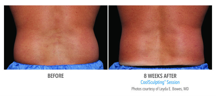 Before---After-men-flank-resize.jpg