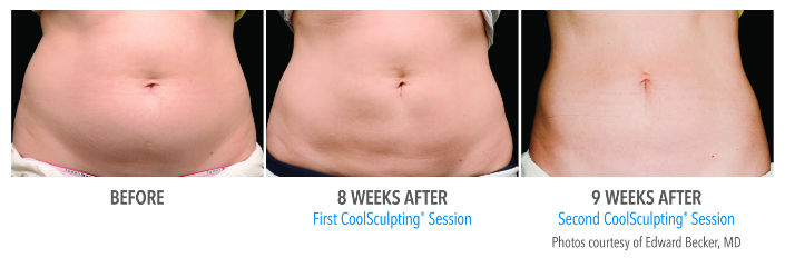 Before---After-photos-resize.jpg